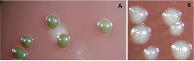 Clinical laboratory diagnostics in dentistry: Application of microbiological methods